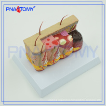 PNT-0756 enlarged pathological human skin model